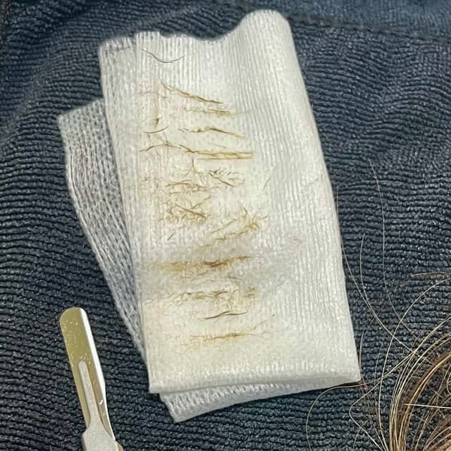 Dermaplane Pro Facial x3 at Mindful Skincare in Elmhurst, IL