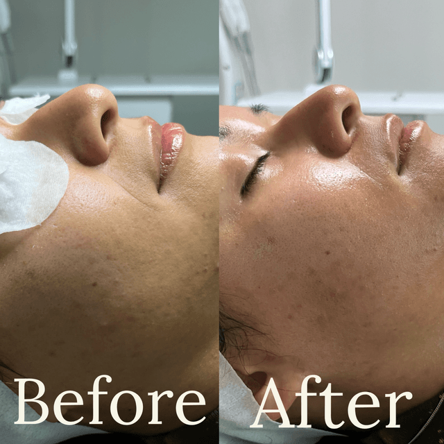 Monthly Facial Club (4 total) at Mindful Skincare in Elmhurst, IL